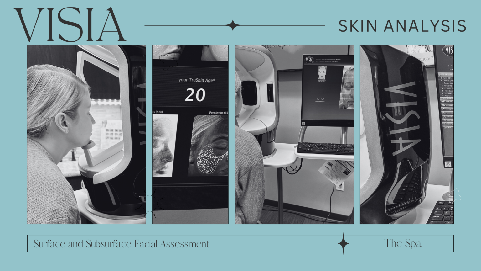 Your Full Skin Analysis With Visia