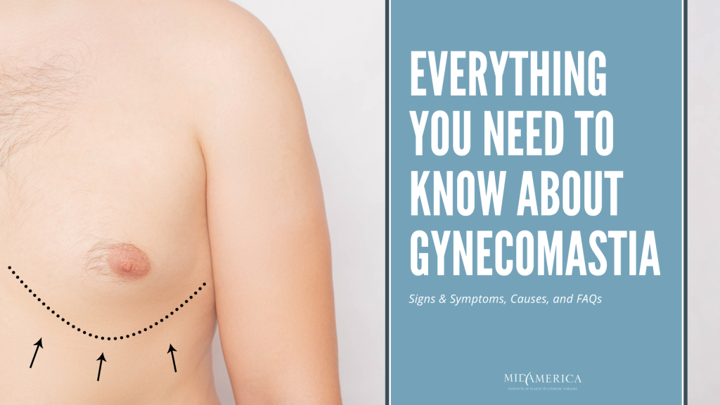 Everything You Need to Know About Gynecomastia